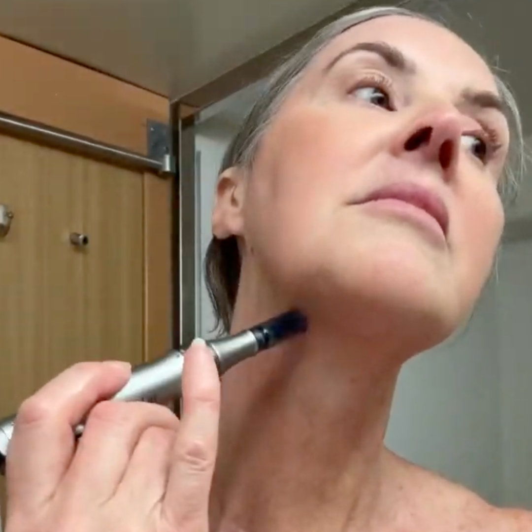 Single silver microneedling pen with a blue tip held against a woman's lower neck in a bathroom.