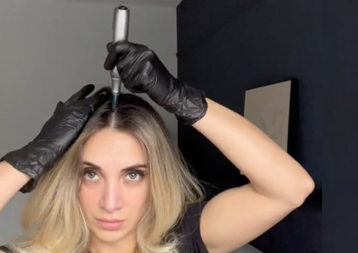 a woman using dr pen m8s on scalp for hair loss