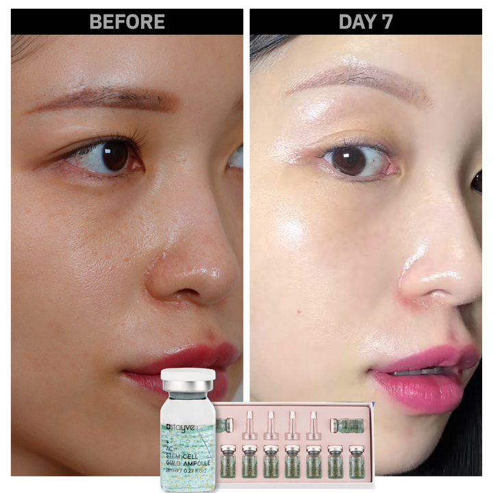 Before and after comparison of a woman's skin area after treatment with AC Stem Cell Gold Ampoule. Skin looks brighter, smaller pores, and more glowing.