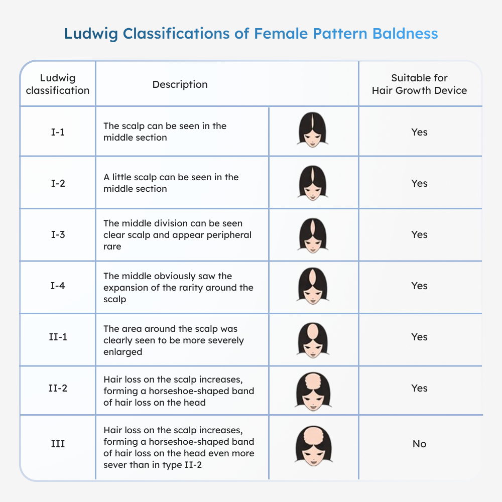 Table of Ludwig classifications for female pattern baldness with corresponding images and suitability for Reboot Volume Max Hair Growth Helmet 