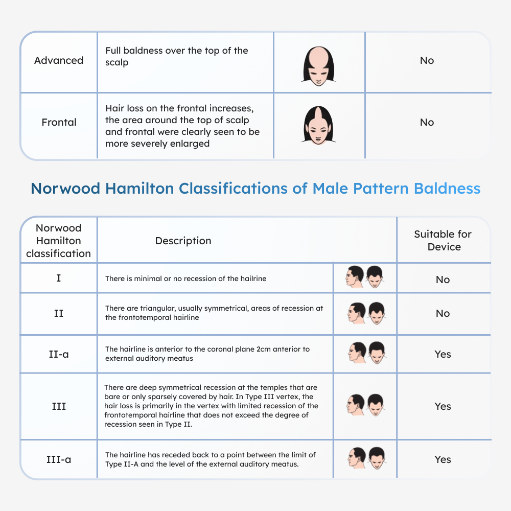2 tables in this image, one with Ludwig classifications for female pattern baldness, Second table detailing the Norwood Hamilton Classification of Male Pattern Baldness with illustrations 