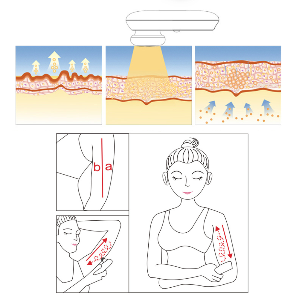 Peachaboo Face and Body Skin Tightening Radio Frequency Device penetration and use