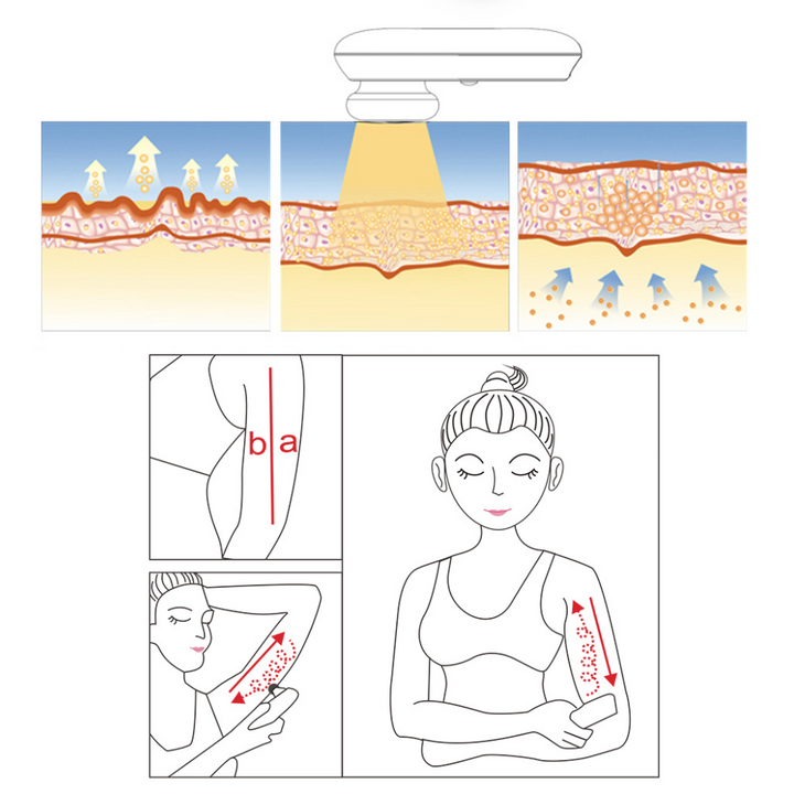 Peachaboo Face and Body Skin Tightening Radio Frequency Device penetration and use
