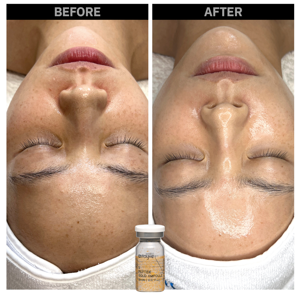 Before and after comparison of a woman's skin area after treatment with Peptide Gold Ampoule. 