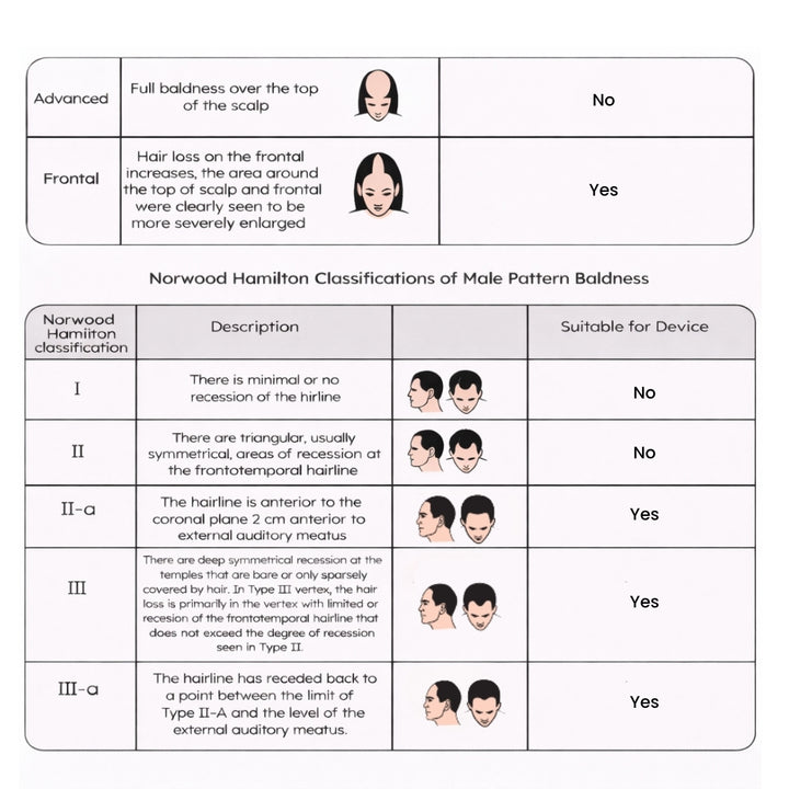 2 tables in this image, one with Ludwig classifications for female pattern baldness, Second table detailing the Norwood Hamilton Classification of Male Pattern Baldness with illustrations 
